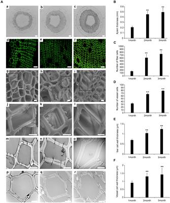 Integrated Transcriptomic and Proteomic Analysis in the Roadmap of the Xylem Development Stage in Populus tomentosa